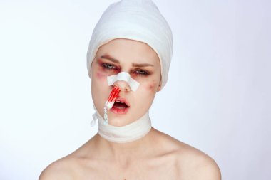 Burnu yaralı, yüzü yaralı duygusal bir kadın tamponu.