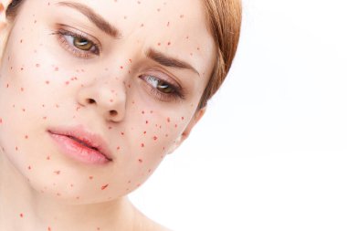 Çıplak omuzlu, dermatoloji sivilceli neşeli bir kadın.