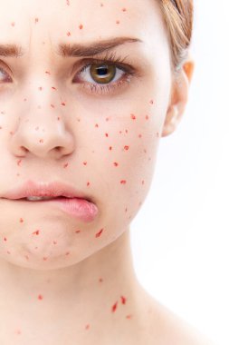 Çıplak omuzlu, dermatoloji sivilceli neşeli bir kadın.