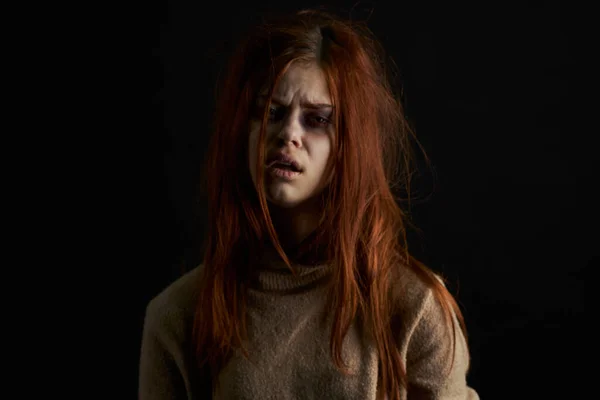 Mujer asustada con moretones bajo sus ojos golpeando el abuso de la depresión — Foto de Stock