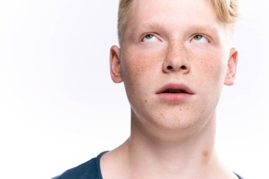 Kızıl saçlı adam çilleri yakın plan stüdyo yaşam tarzı olarak gösteriyor.