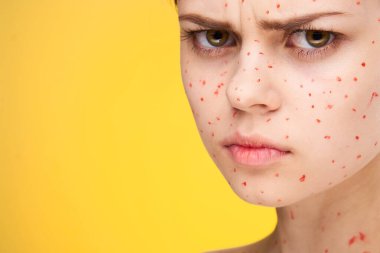 Yüzünde kırmızı noktalar olan kadın cilt sorunları dermatoloji tatminsizliği