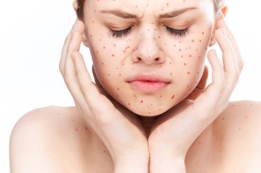 Çıplak omuzlu, dermatoloji sivilceli neşeli bir kadın.
