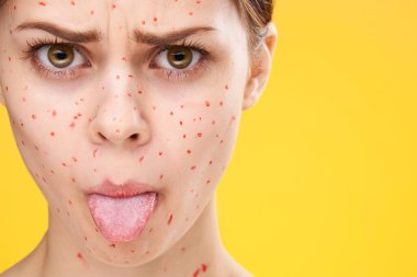 Yüzünde kırmızı noktalar olan kadın cilt sorunları dermatoloji tatminsizliği