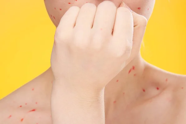 Женское лицо обрезанный вид красные точки на коже лица проблемы — стоковое фото