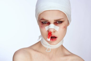 Burnu yaralı duygusal kadın tamponu. Stüdyo hayatı gibi.