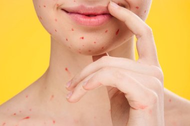 Kadın yüzü, yüz derisindeki kırmızı noktalar ile kırpılmış.