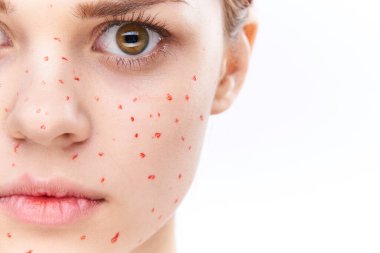 Çıplak omuzlu, dermatoloji sivilceli neşeli bir kadın.