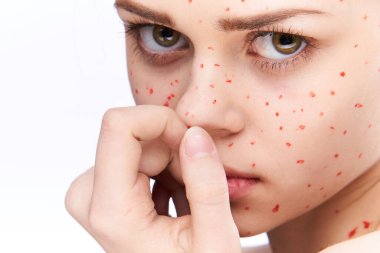 Çıplak omuzlu, dermatoloji sivilceli neşeli bir kadın.