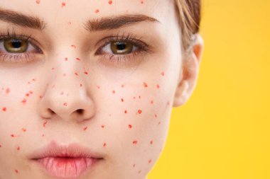 Yüzünde kırmızı noktalar olan kadın cilt sorunları dermatoloji tatminsizliği