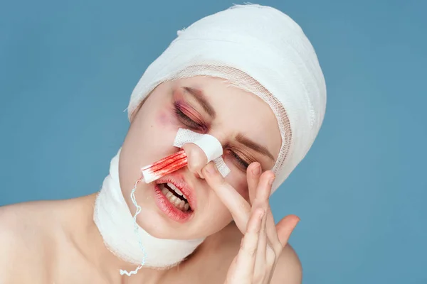 Жінка тампон в носі з пошкодженим обличчям студійний спосіб життя — стокове фото