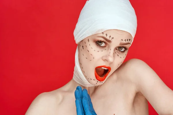 Női beteg pózol kék kesztyűben piros ajkak műtét arc fiatalítás izolált háttér — Stock Fotó