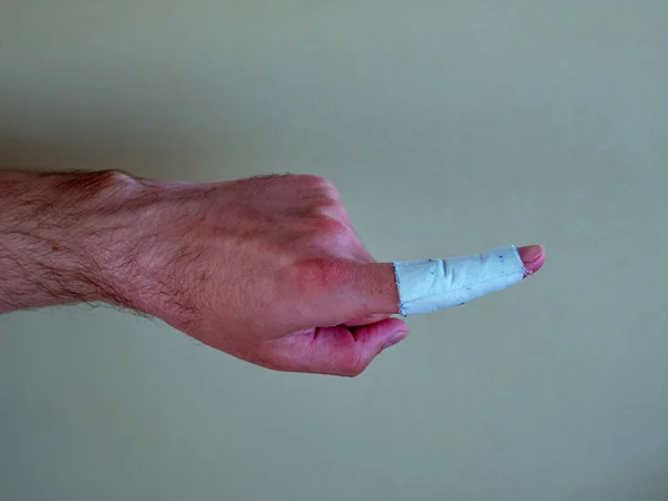 Een hand met plakband gelijmd op het beschadigde gebied van de huid. — Stockfoto