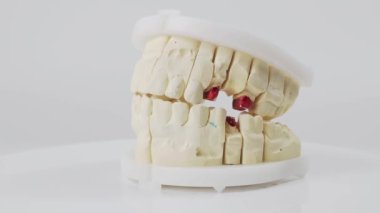 Plaster model or cast of human teeth. Teeth model on a white background.