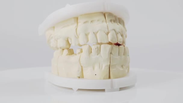 Gipsmodel Gips Van Menselijke Tanden Tanden Model Een Witte Achtergrond — Stockvideo