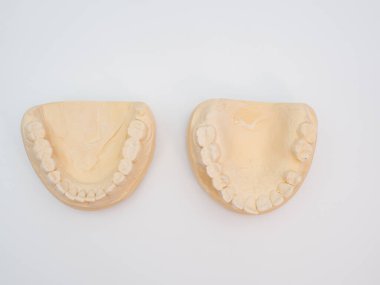 Alçı ya da insan dişi kalıbı. Beyaz arkaplanda diş modeli.