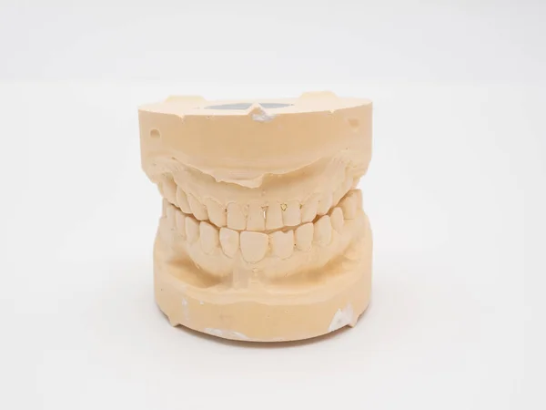 Plaster Model Cast Human Teeth Teeth Model White Background — Photo