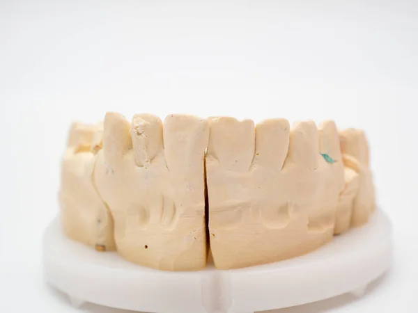 Plaster Model Cast Human Teeth Teeth Model White Background — Stock Photo, Image