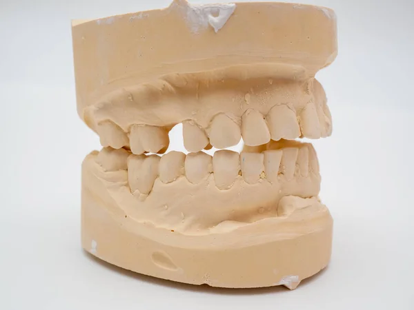 Plaster model or cast of human teeth. Teeth model on a white background.