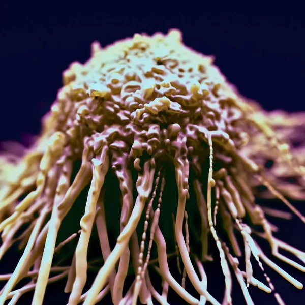 Ilustración Células Cancerosas — Foto de Stock