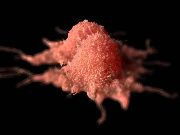 3Dイラスト がん細胞事業部 — ストック写真