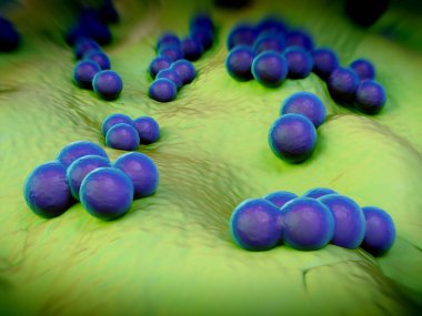 süperböcek veya Staphylococcus aureus (MRSA) bakterisi
