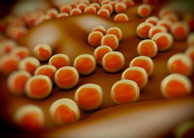 süperböcek veya Staphylococcus aureus (MRSA) bakterisi