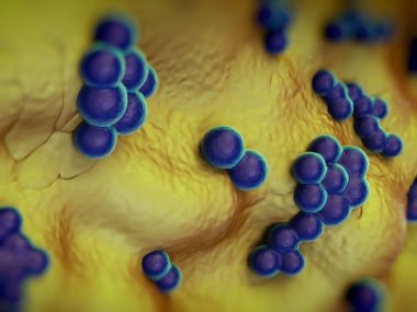 süperböcek veya Staphylococcus aureus (MRSA) bakterisi