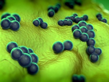 süperböcek veya Staphylococcus aureus (MRSA) bakterisi