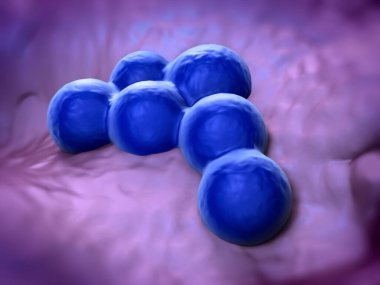 süperböcek veya Staphylococcus aureus (MRSA) bakterisi