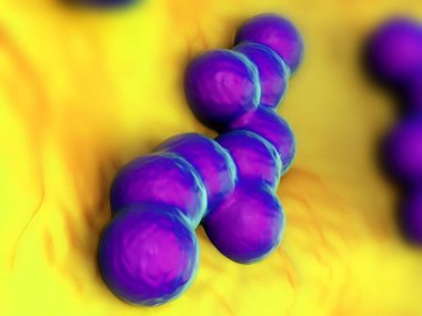 süperböcek veya Staphylococcus aureus (MRSA) bakterisi
