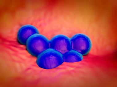 süperböcek veya Staphylococcus aureus (MRSA) bakterisi