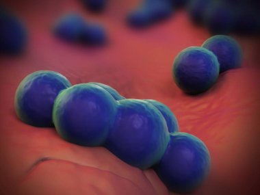süperböcek veya Staphylococcus aureus (MRSA) bakterisi
