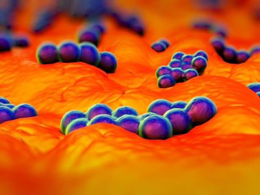 süperböcek veya Staphylococcus aureus (MRSA) bakterisi