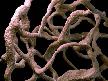 Osteoporotik kemik, sağlıksız kemik yapısı yakın çekim