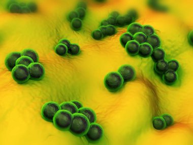 süperböcek veya Staphylococcus aureus (MRSA) bakterisi