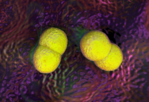 superbug or Staphylococcus aureus (MRSA) bacteria