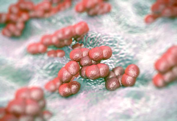 süperböcek veya Staphylococcus aureus (MRSA) bakterisi