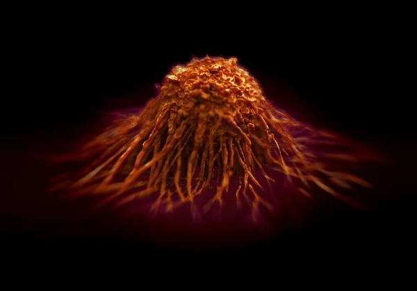 Nahaufnahme Von Krebszellen — Stockfoto