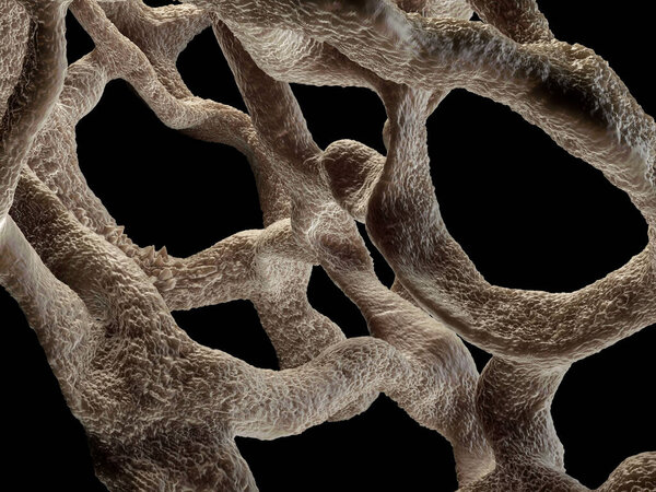 Osteoporotic bone , unhealthy bone structure close-up view