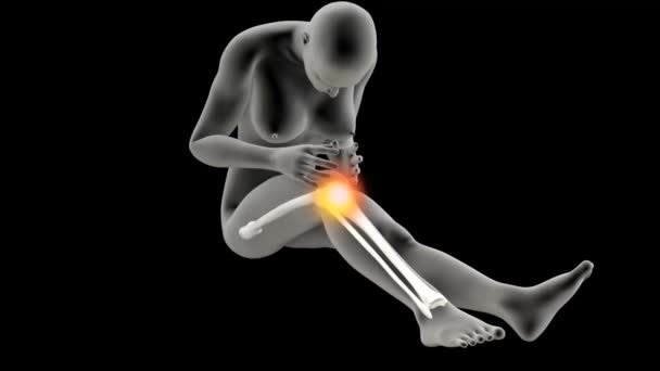 Human Anatomical Knee Pain — Stock Video