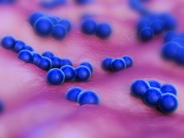 süperböcek veya Staphylococcus aureus (MRSA) bakterisi