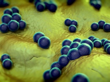 süperböcek veya Staphylococcus aureus (MRSA) bakterisi