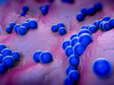 süperböcek veya Staphylococcus aureus (MRSA) bakterisi