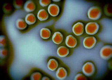 süperböcek veya Staphylococcus aureus (MRSA) bakterisi