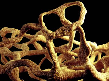 Osteoporotik kemik, sağlıksız kemik yapısı yakın çekim