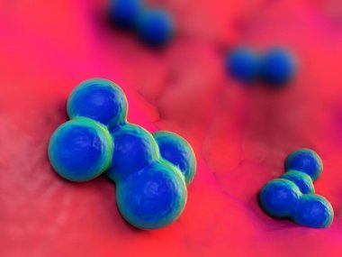 süperböcek veya Staphylococcus aureus (MRSA) bakterisi
