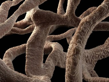 Osteoporotik kemik, sağlıksız kemik yapısı yakın çekim