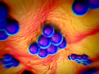 süperböcek veya Staphylococcus aureus (MRSA) bakterisi