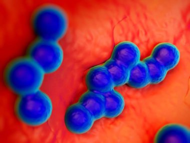 süperböcek veya Staphylococcus aureus (MRSA) bakterisi